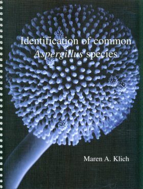 Identification of Common Aspergillus Species