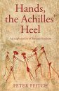 Hands, the Achilles' Heel