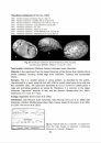 Cenozoic Non-Marine and Brackish Water Gastropods from Italy