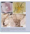 La Diversification des Échinodermes au Paléozoïque Inférieur: L'Apport des Gisements à Préservation Exceptionelle [The Diversification of Echinoderms in the Lower Paleozoic: The Contribution of Deposits with Exceptional Preservation]