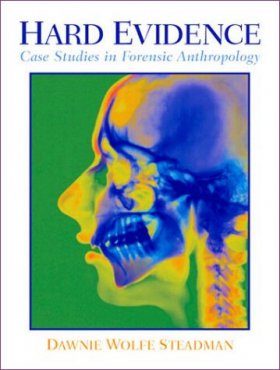 Forensic Anthropology Case Study