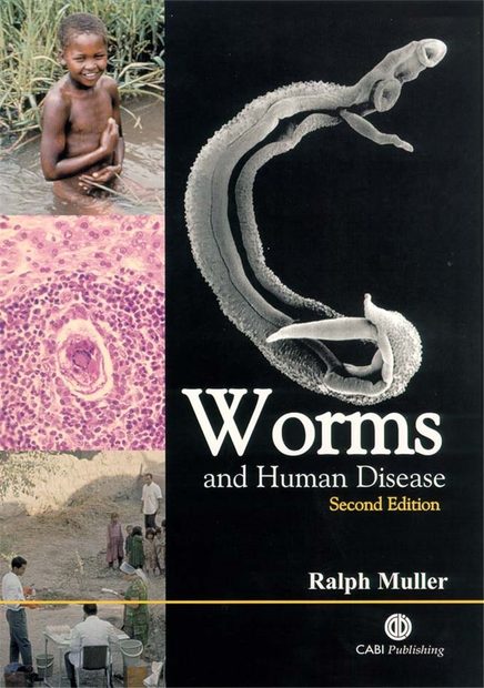 Worms and Human Disease