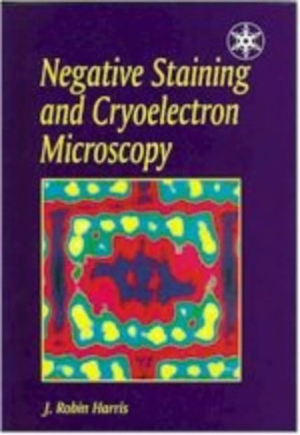 Negative Staining and Cryoelectron Microscopy: The Thin Film Techniques