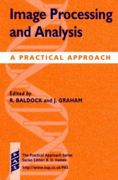 Image Processing and Analysis: A Practical Approach